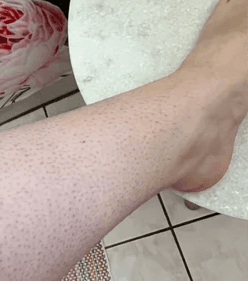 Before using product