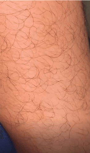 Skin Before using Shevra